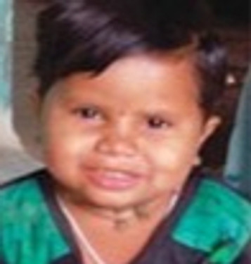 Severe Malnutrition Control