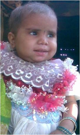 Lakshmi After Treatment