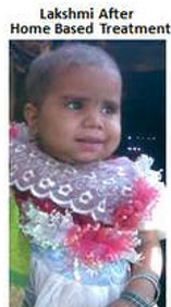 Lakshmi after home based treatment