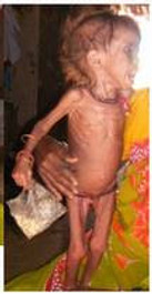 Laxmi before treatment